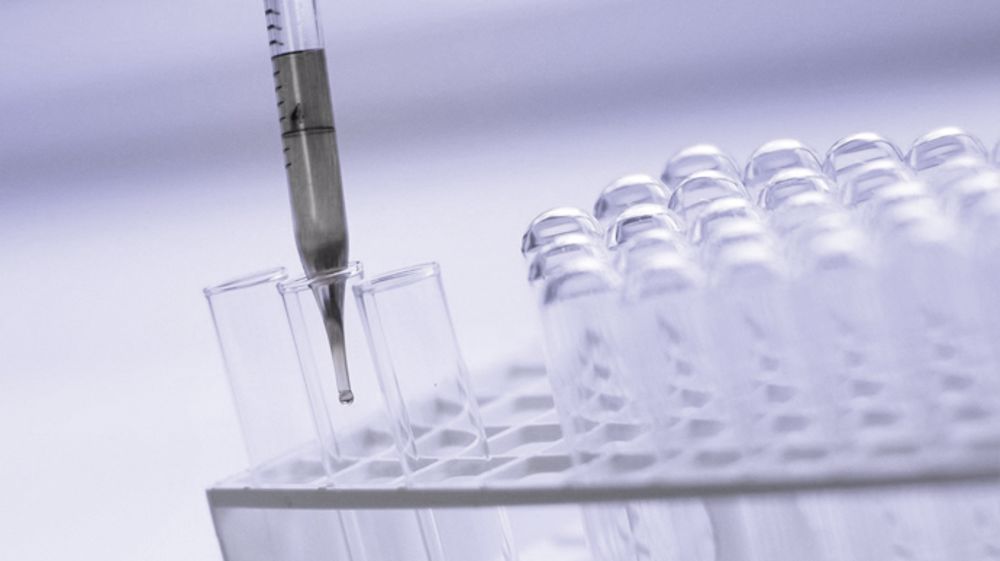 La FRSEA Bretagne dénonce une fiabilité douteuse des tests Elisa utilisés pour détecter la présence de glyphosate dans les urines. (©Terre-net Média/Pixabay)
