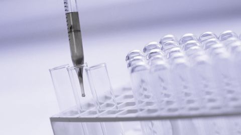 La FRSEA Bretagne dénonce une fiabilité douteuse des tests Elisa utilisés pour détecter la présence de glyphosate dans les urines. (©Terre-net Média/Pixabay) La FRSEA Bretagne dénonce une fiabilité douteuse des tests Elisa utilisés pour détecter la présence de glyphosate dans les urines. (©Terre-net Média/Pixabay)