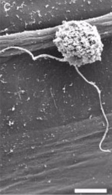 Spore mildiou au microscope