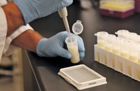 Le kit Idexx de détection de la gestation est un test immuno-enzymatique permettant de détecter, dans les échantillons de lait, les glycoprotéines associées à la gestation. Le kit Idexx de détection de la gestation est un test immuno-enzymatique permettant de détecter, dans les échantillons de lait, les glycoprotéines associées à la gestation.