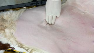 Une hernie ombilicale présente une masse molle et fuyante à la palpation à la différence d'une infection du nombril. Pluseurs facteurs sont à l'origine des hernies dont une composante génétique. Une hernie ombilicale présente une masse molle et fuyante à la palpation à la différence d'une infection du nombril. Pluseurs facteurs sont à l'origine des hernies dont une composante génétique.