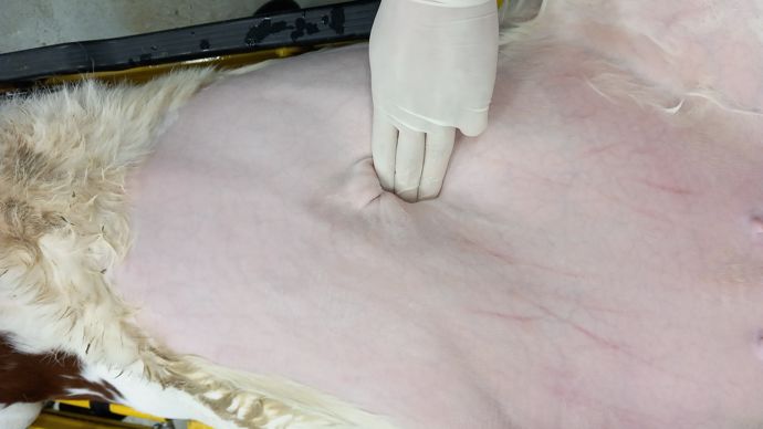 Une hernie ombilicale présente une masse molle et fuyante à la palpation à la différence d'une infection du nombril. Pluseurs facteurs sont à l'origine des hernies dont une composante génétique.