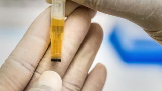 Selon l'enquête menée par les trois FRSEA, le test Elisa détecte des « faux positifs » de glyphosate. Selon l'enquête menée par les trois FRSEA, le test Elisa détecte des « faux positifs » de glyphosate.