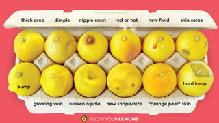 Le schéma proposé par la fondation « Know Your lemons » détaille les 12 symptômes du cancer du sein pour vous aider à réaliser un auto-examen. Le schéma proposé par la fondation « Know Your lemons » détaille les 12 symptômes du cancer du sein pour vous aider à réaliser un auto-examen.