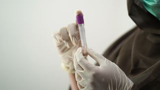 Actuellement remboursé à l'hôpital, le dépistage du cadmium le sera aussi en médecine de ville à l'automne pour les patients à risque. Actuellement remboursé à l'hôpital, le dépistage du cadmium le sera aussi en médecine de ville à l'automne pour les patients à risque.
