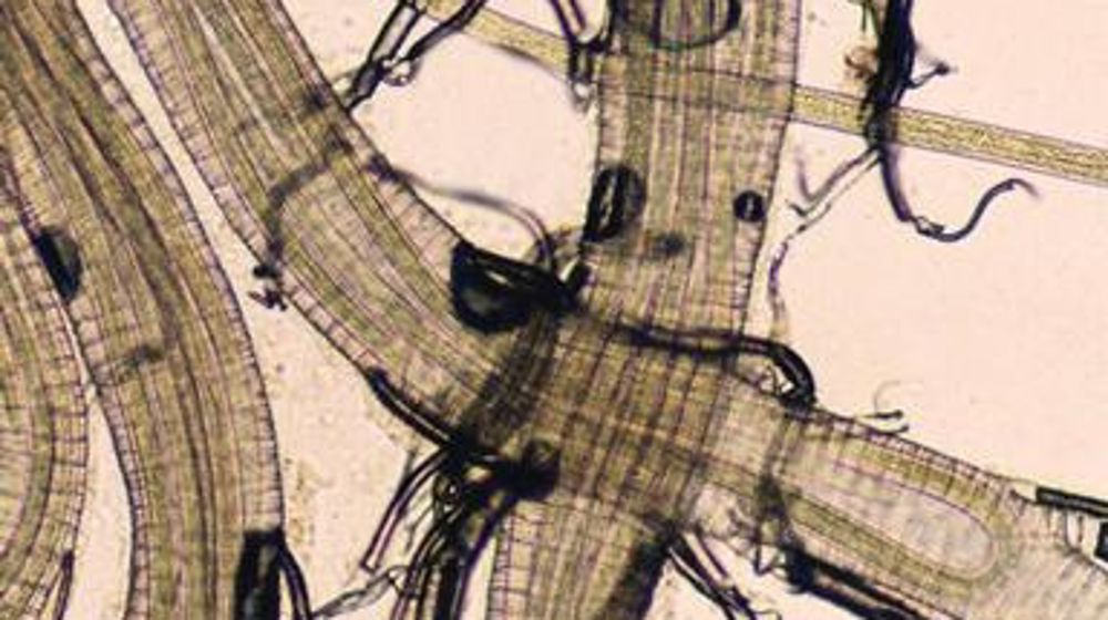 Bursaphelenchus xylophilus