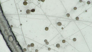 Des racines entourées de champignons mycorhiziens.