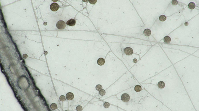 Des racines entourées de champignons mycorhiziens.